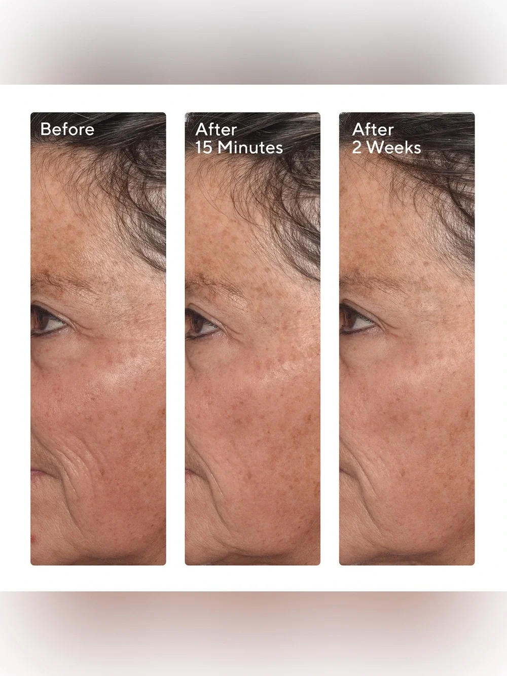 Murad Targeted Wrinkle Corrector 0.5 fl oz (15 ml) tube